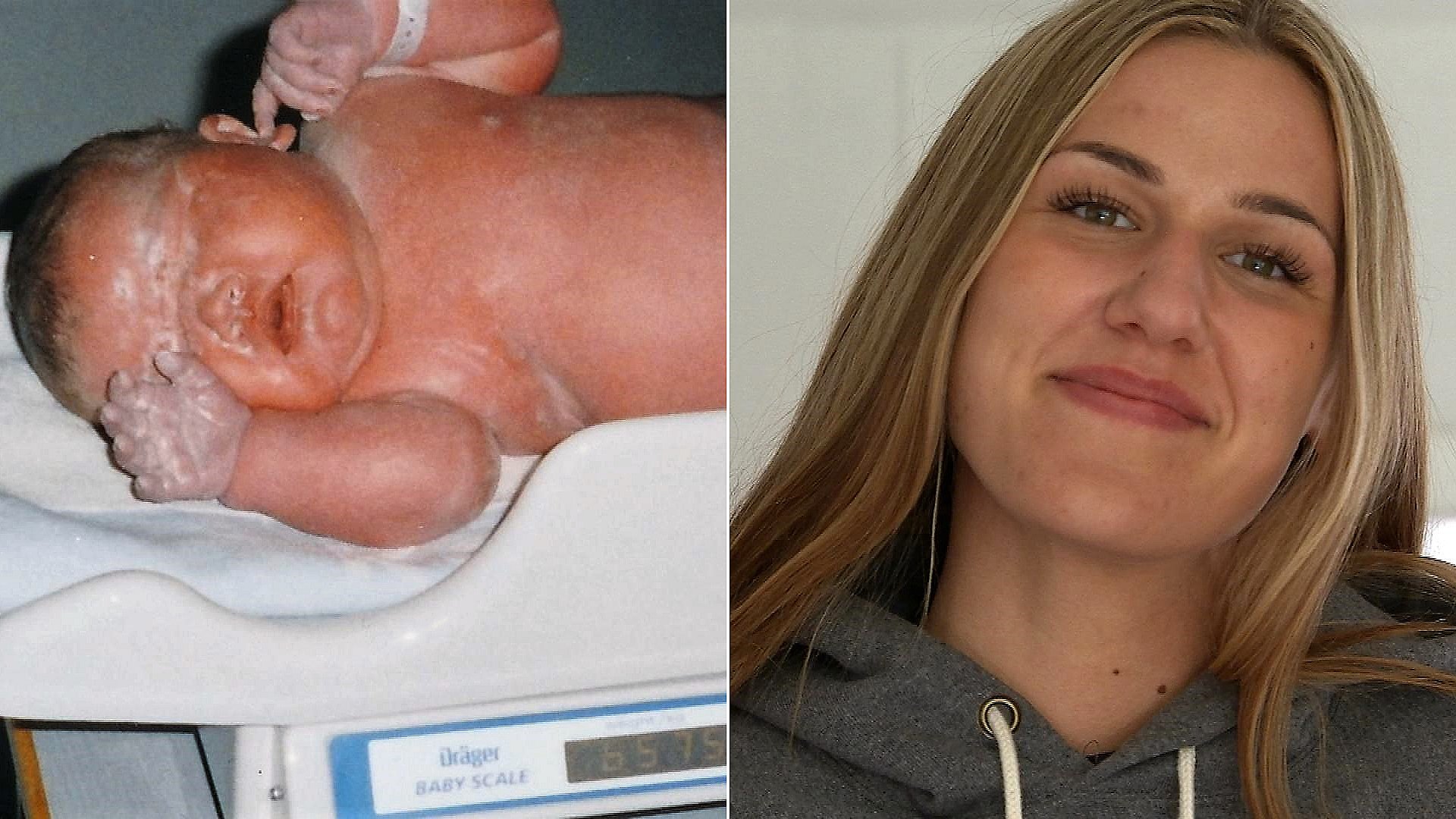 Forståelse når som helst Bliv oppe Vild forvandling: Danmarks tungeste baby blev til klassens tynde pige | TV  MIDTVEST